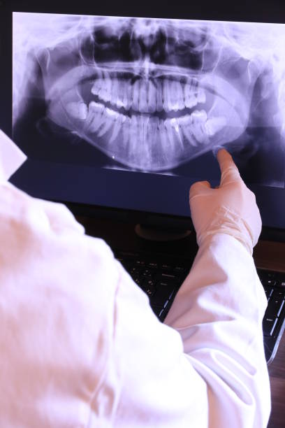 Best Emergency Treatment for Dental Infections or Abscesses in Ontario, OH