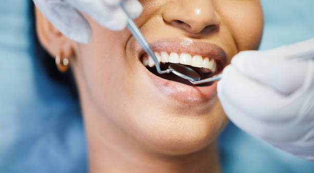 Best Emergency Dental Care for Broken or Chipped Teeth in Ontario, OH