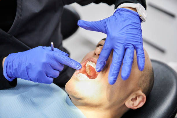 Best Emergency Dental Care for Broken or Chipped Teeth in Ontario, OH